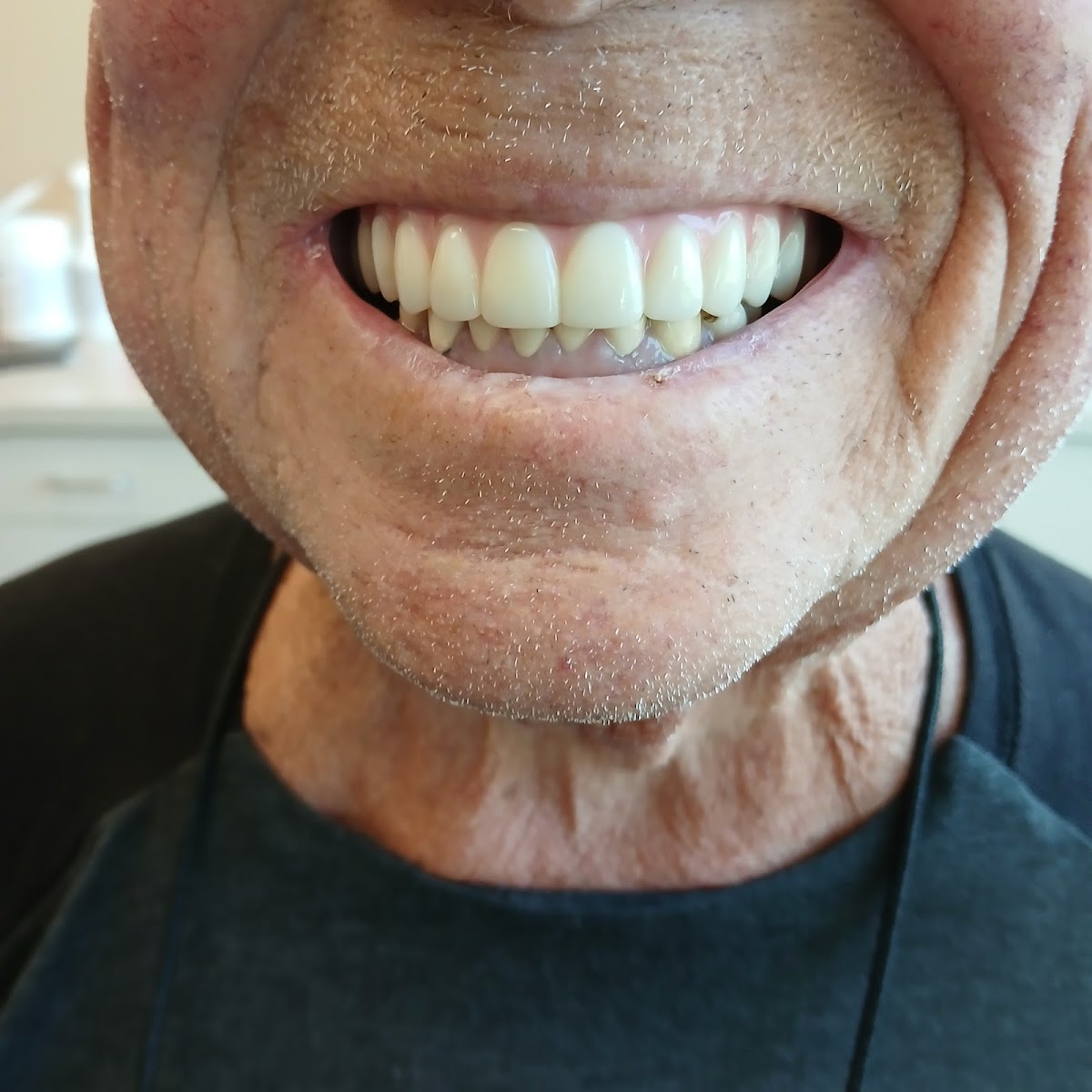 Clearchoice Dental Implant Center - San Diego photo 3