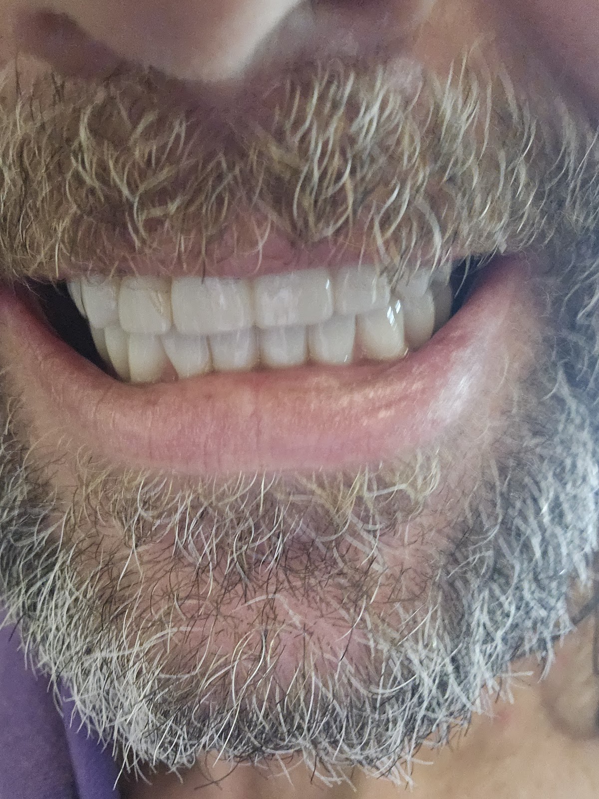 Clearchoice Dental Implant Center - San Diego photo 6