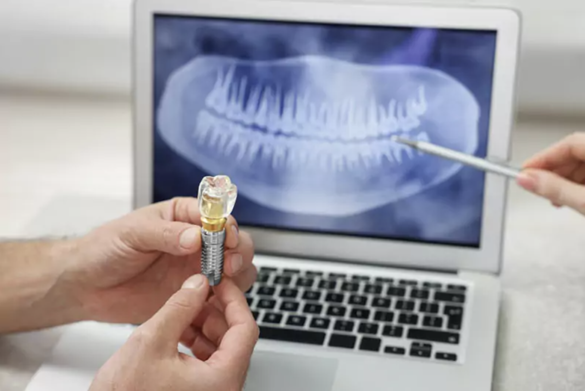 I-implant Dentistry photo 3