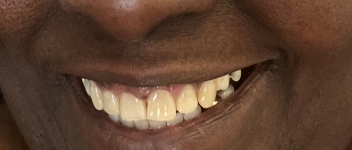 Affordable Smiles of Houma photo 3