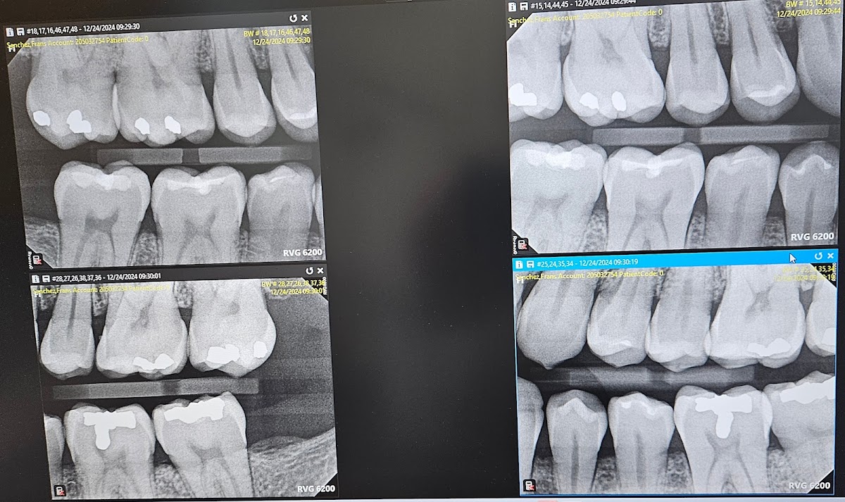 Aspen Dental - Lewisville photo 1