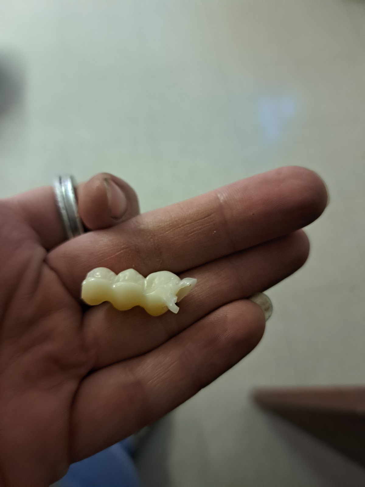 Aspen Dental - Wake Forest photo 3