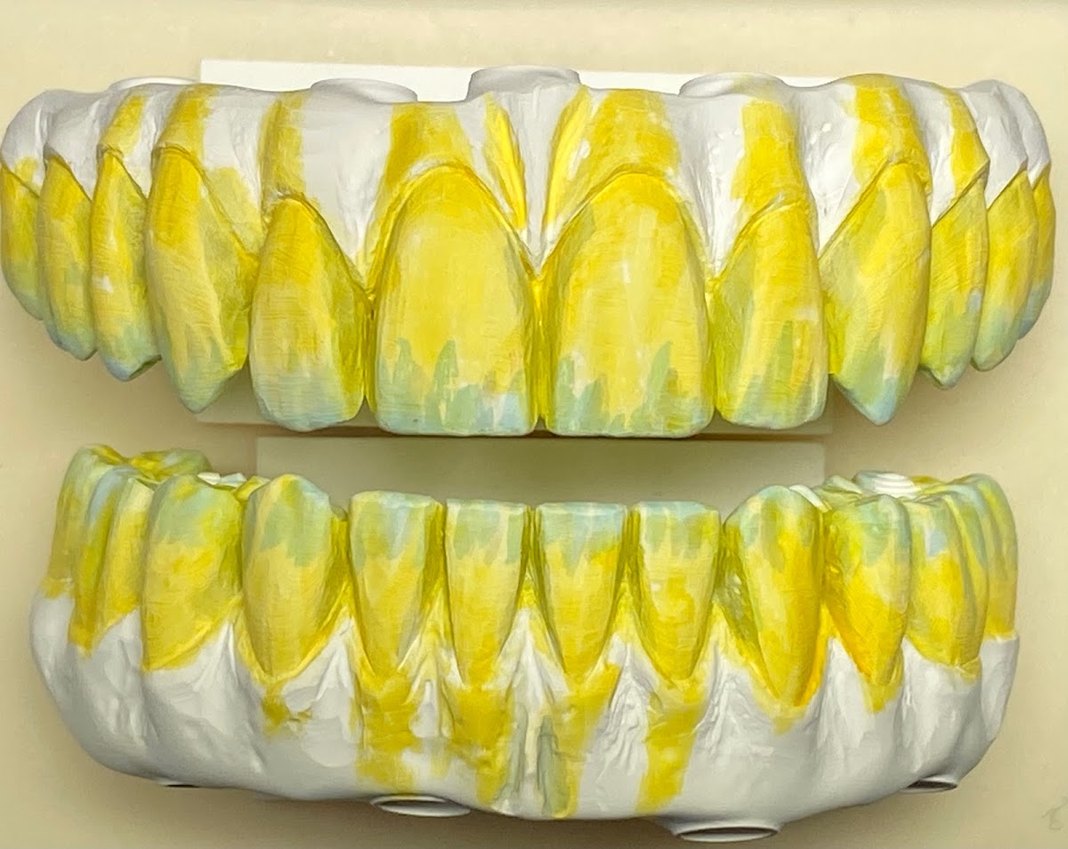 Stone Ridge Dental: Implant, Cosmetic & Prosthetic Dentistry photo 5