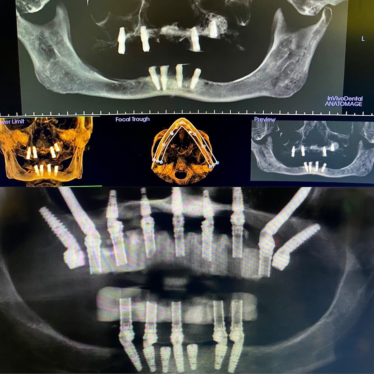 Stone Ridge Dental: Implant, Cosmetic & Prosthetic Dentistry photo 6
