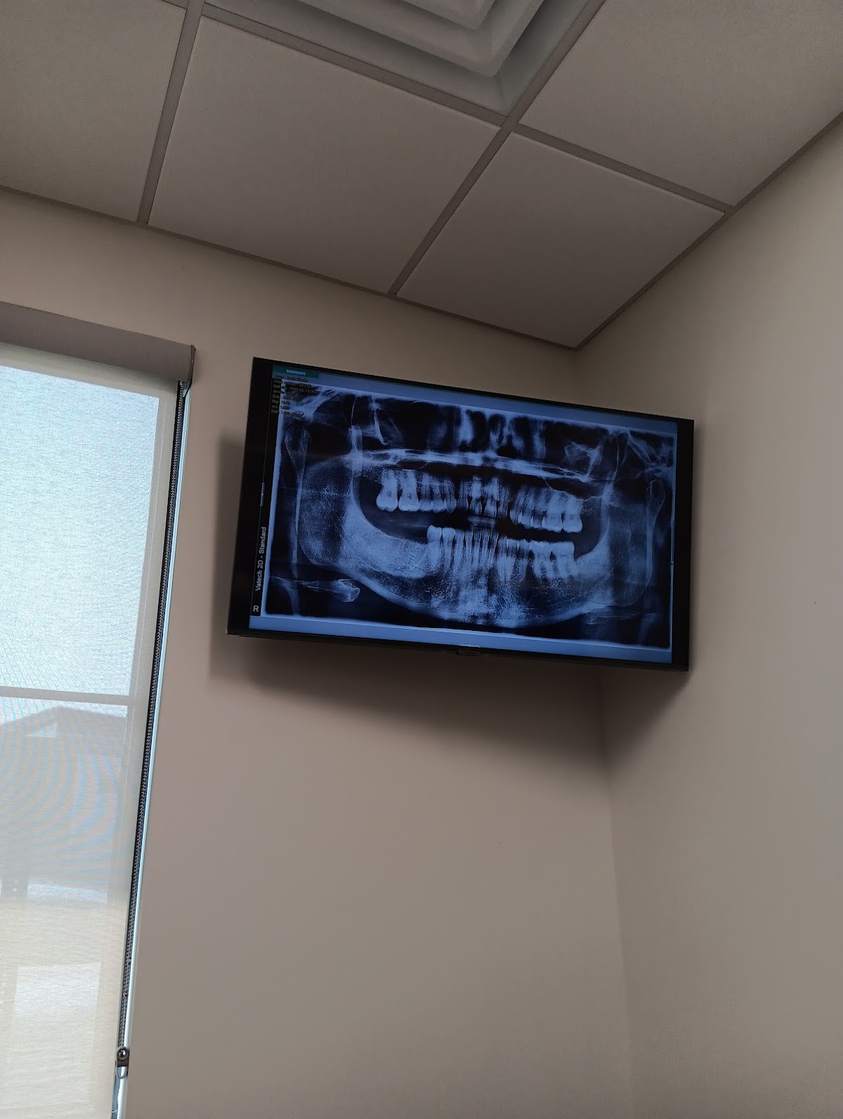 Premier Dental Center - Jackson photo 5