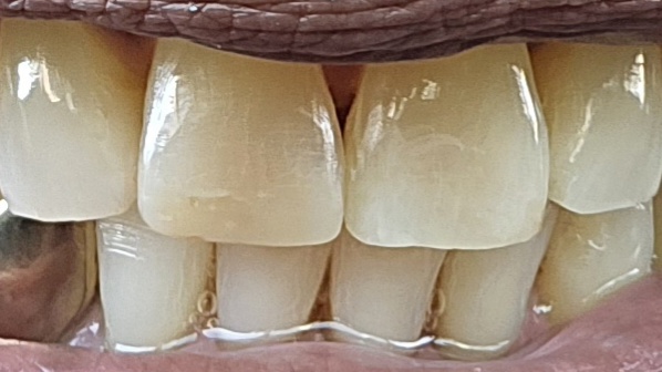Stonehaven Dental & Orthodontics - Harker Heights photo 6
