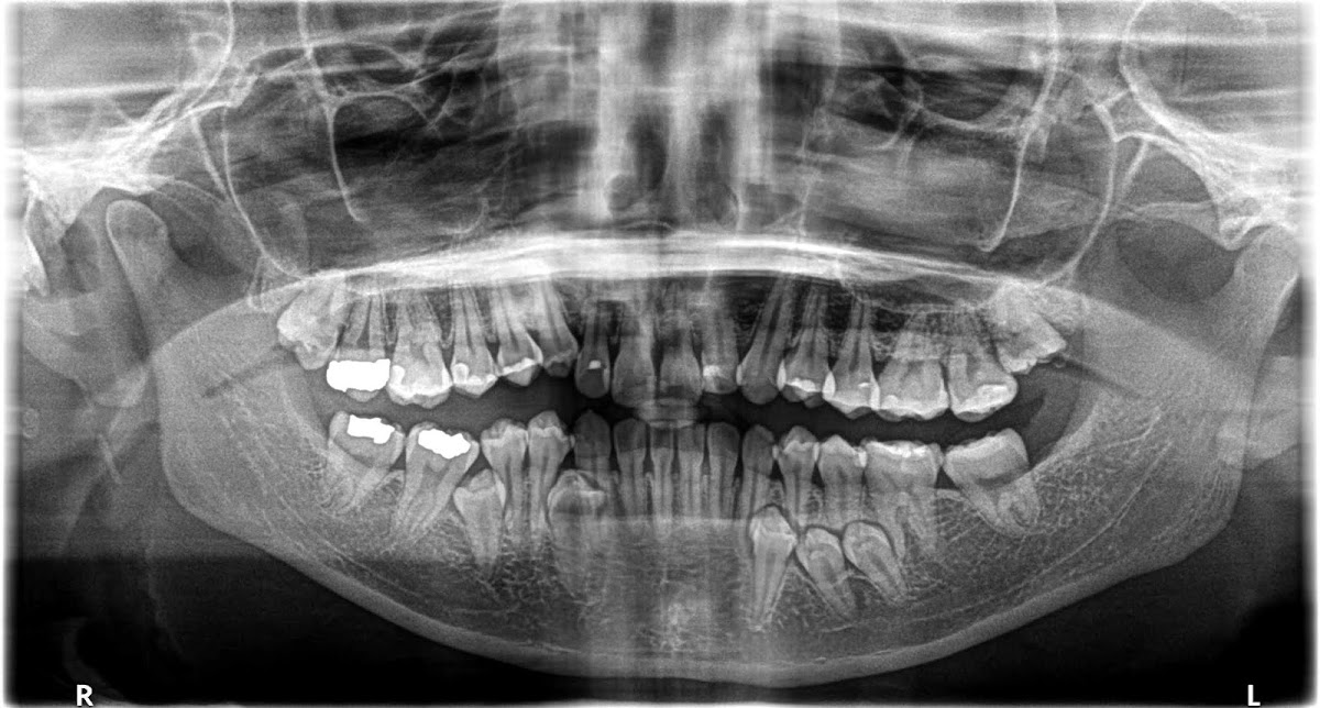 Oral Facial Reconstruction and Implant Center - Plantation photo 1