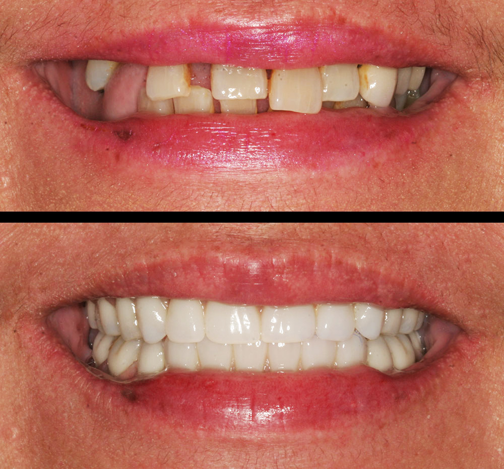 4m Dental Implant Center photo 1