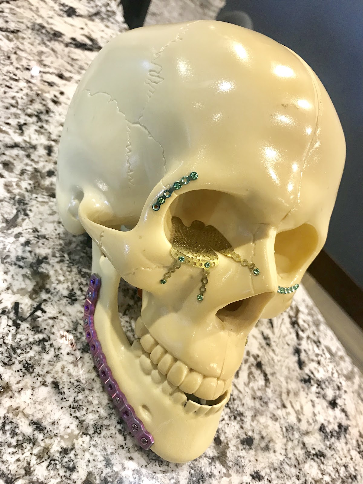 Summit Oral Surgery photo 6