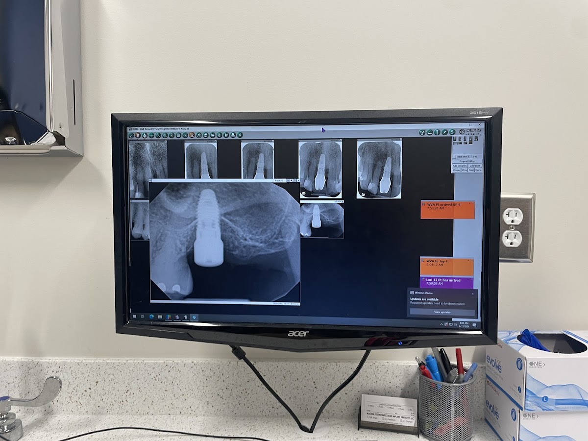 Macon Periodontics & Implant Dentistry, LLC - Dr. William Argo, Dr. Thomas Peterson, & Dr. Kyle Garrett photo 4