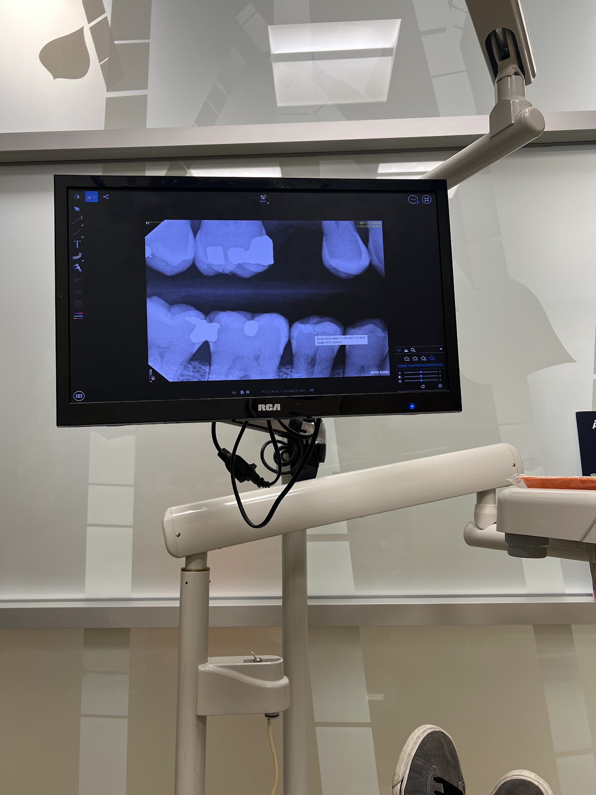 Aspen Dental - York photo 3