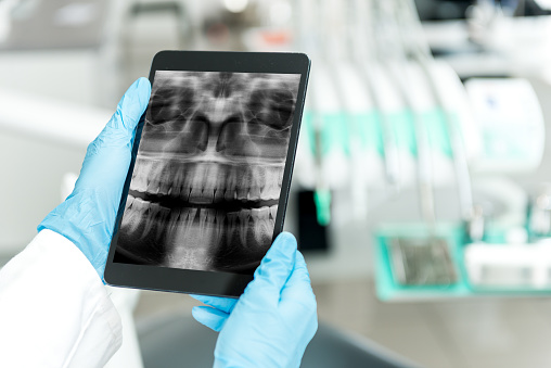 Yj Oms Dental Implants & Oral Surgery photo 2