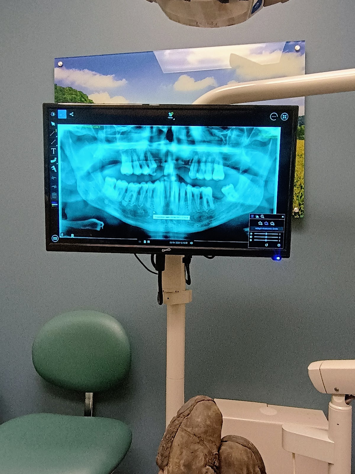 Aspen Dental - Mishawaka photo 3