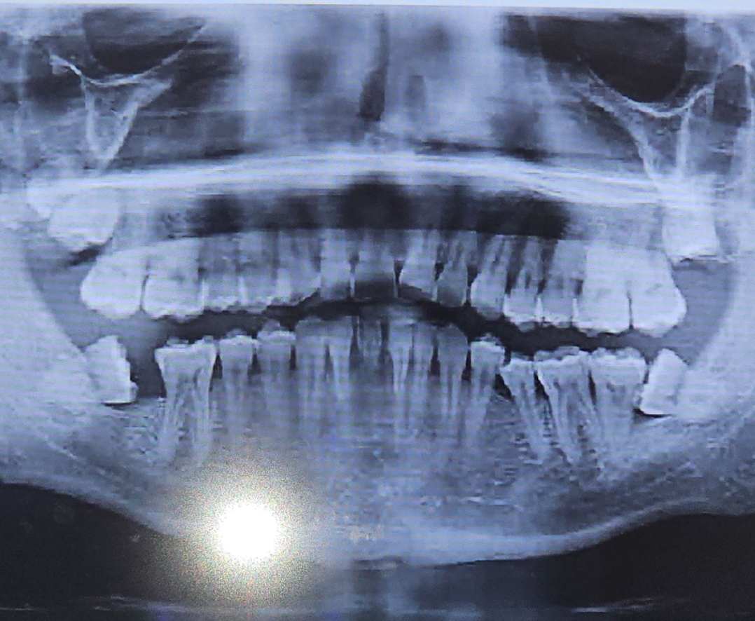 Suncoast Oral Surgery Specialist photo 5