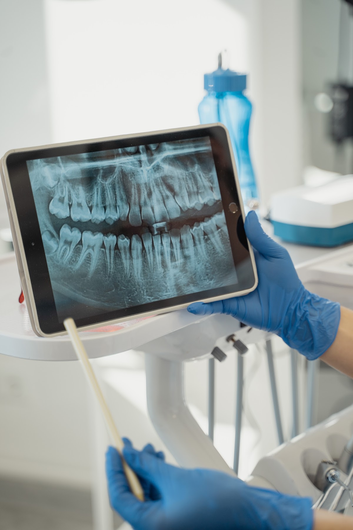 Ventura Bright Dental (Dental Implant Center) photo 5