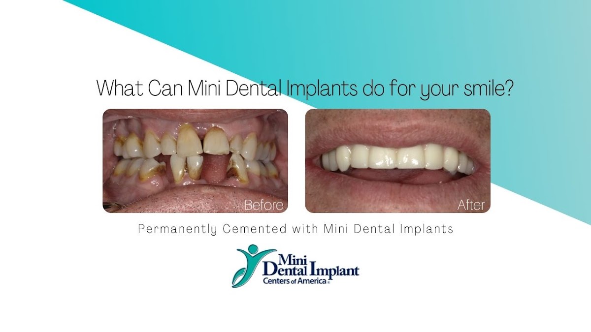 Mini Dental Implant Center of Zanesville photo 1