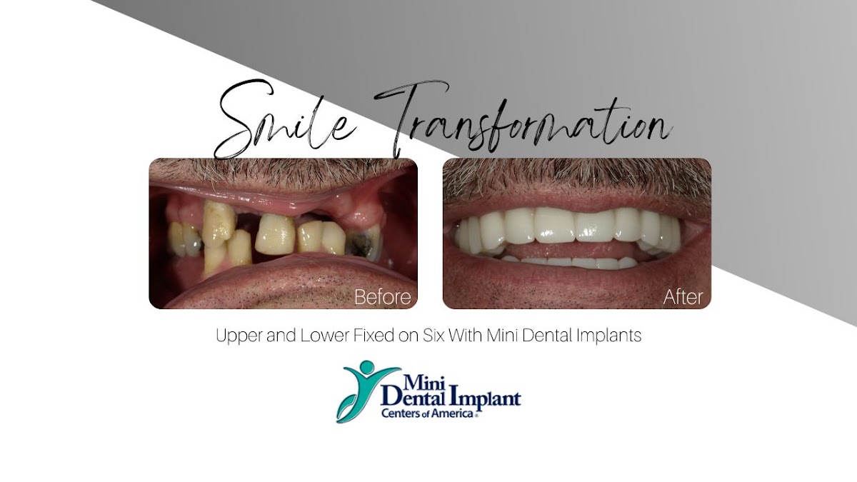 Mini Dental Implant Center of Zanesville photo 2
