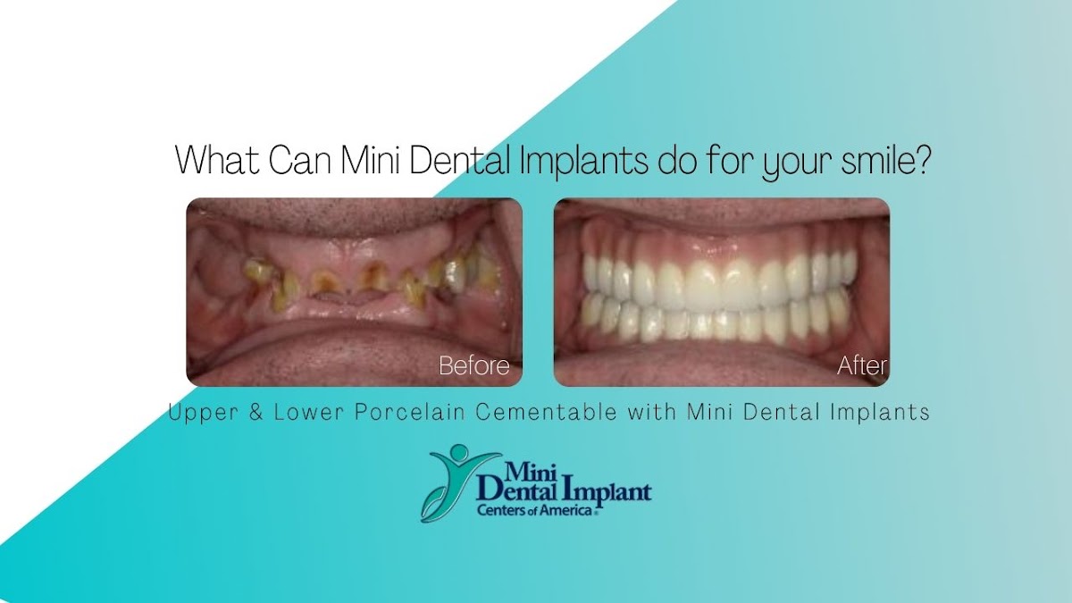 Mini Dental Implant Center of Zanesville photo 3