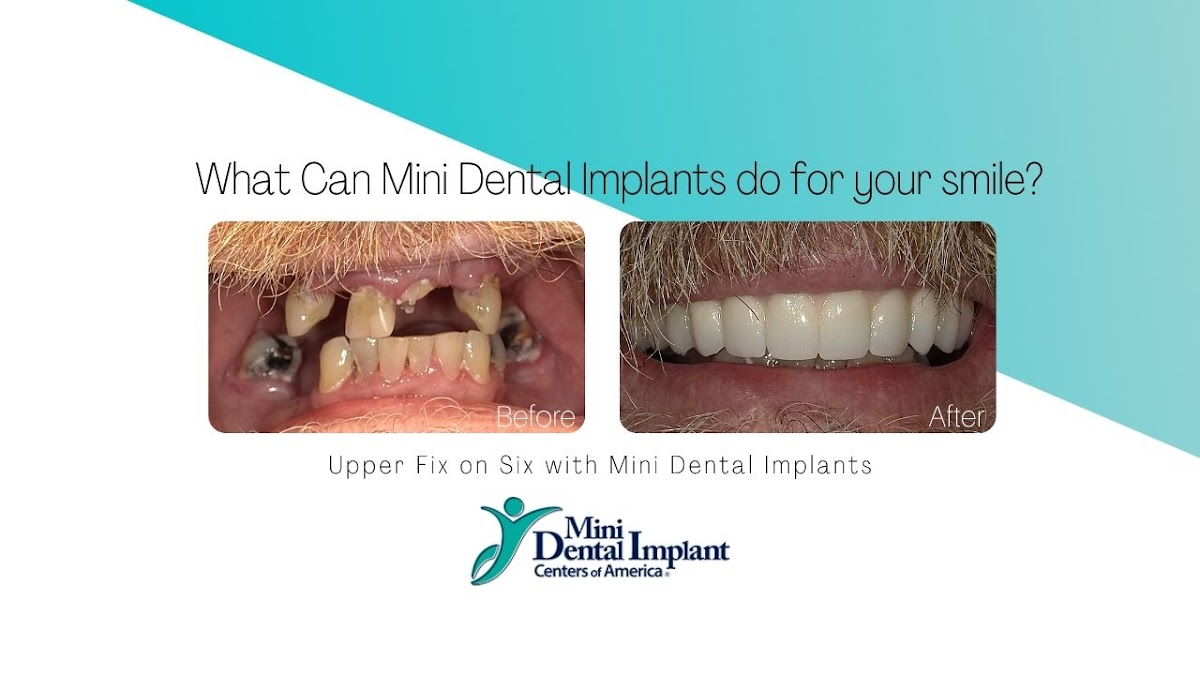 Mini Dental Implant Center of Zanesville photo 4