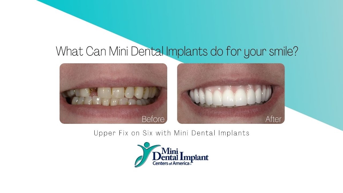 Mini Dental Implant Center of Zanesville photo 5
