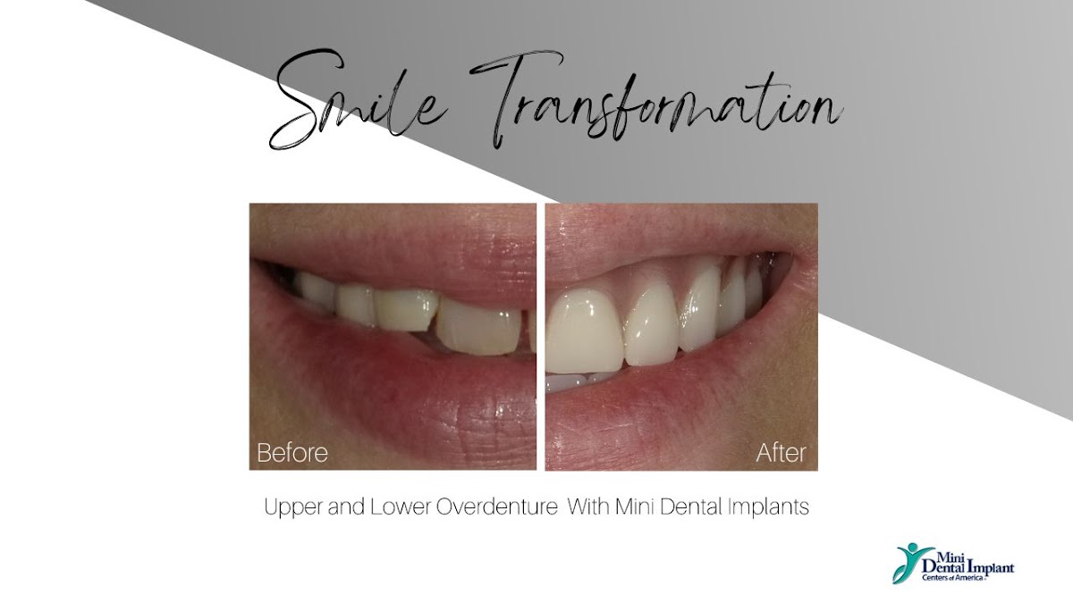 Mini Dental Implant Center of Zanesville photo 6