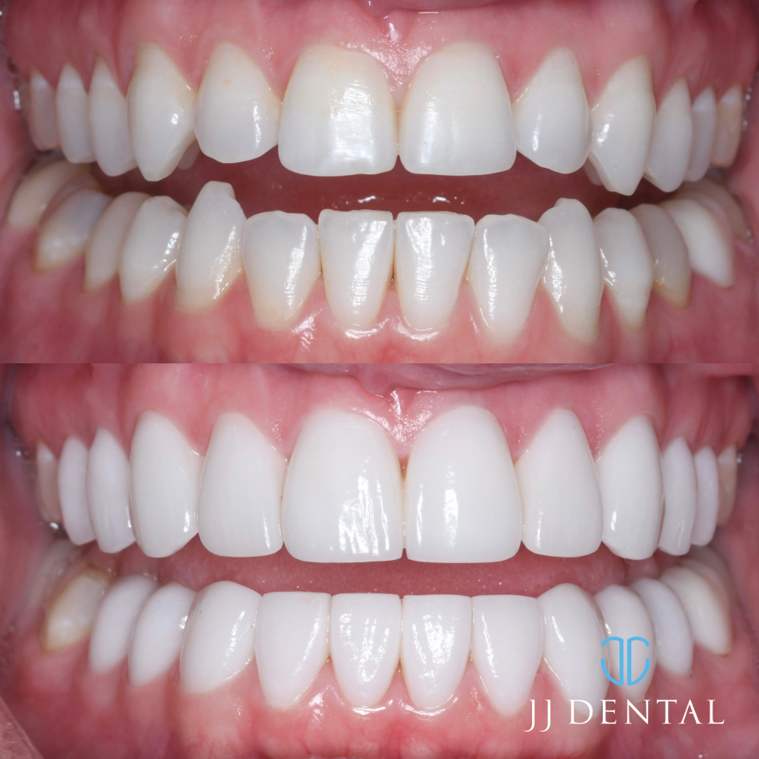 Jj Dental photo 1
