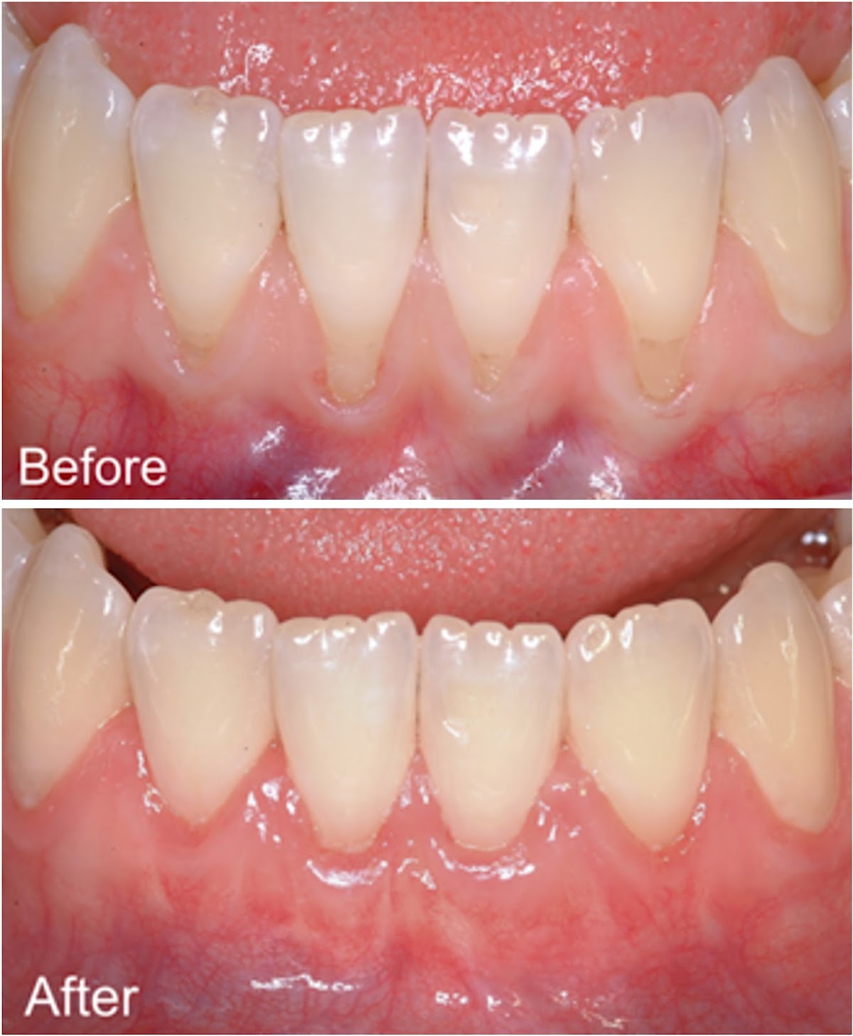 Affordable Dental Implant Excellence/ Implant Dentures/ Tmj and Headaches/ Thomas E. Bramanti, DDS, PHD, Inc photo 2