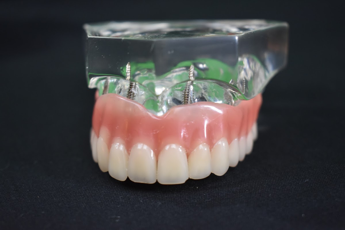 Denturecare and Implant Solutions photo 2