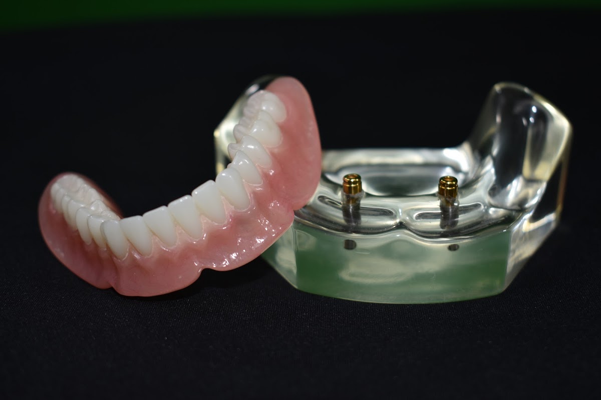 Denturecare and Implant Solutions photo 4