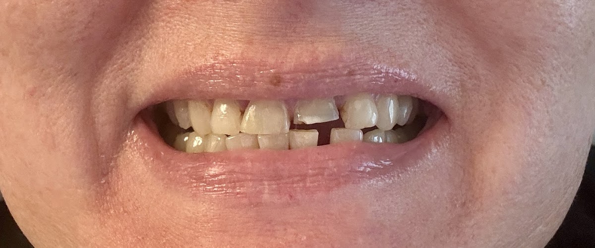 Spivey Family Dentistry photo 6