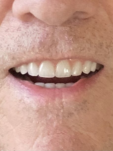 Affordable Dentures & Implants - Chattanooga photo 2