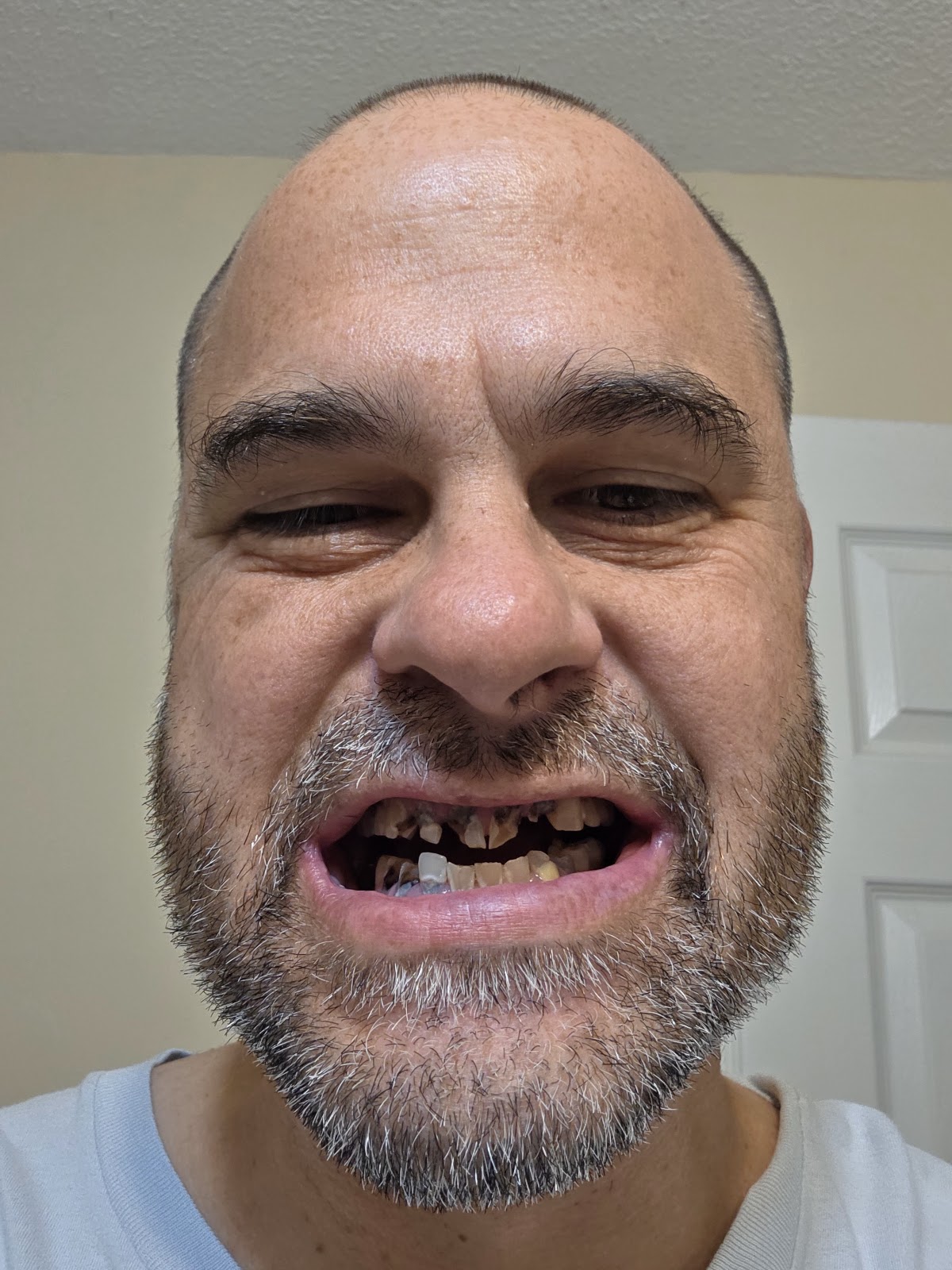 Affordable Dentures & Implants - Chattanooga photo 6