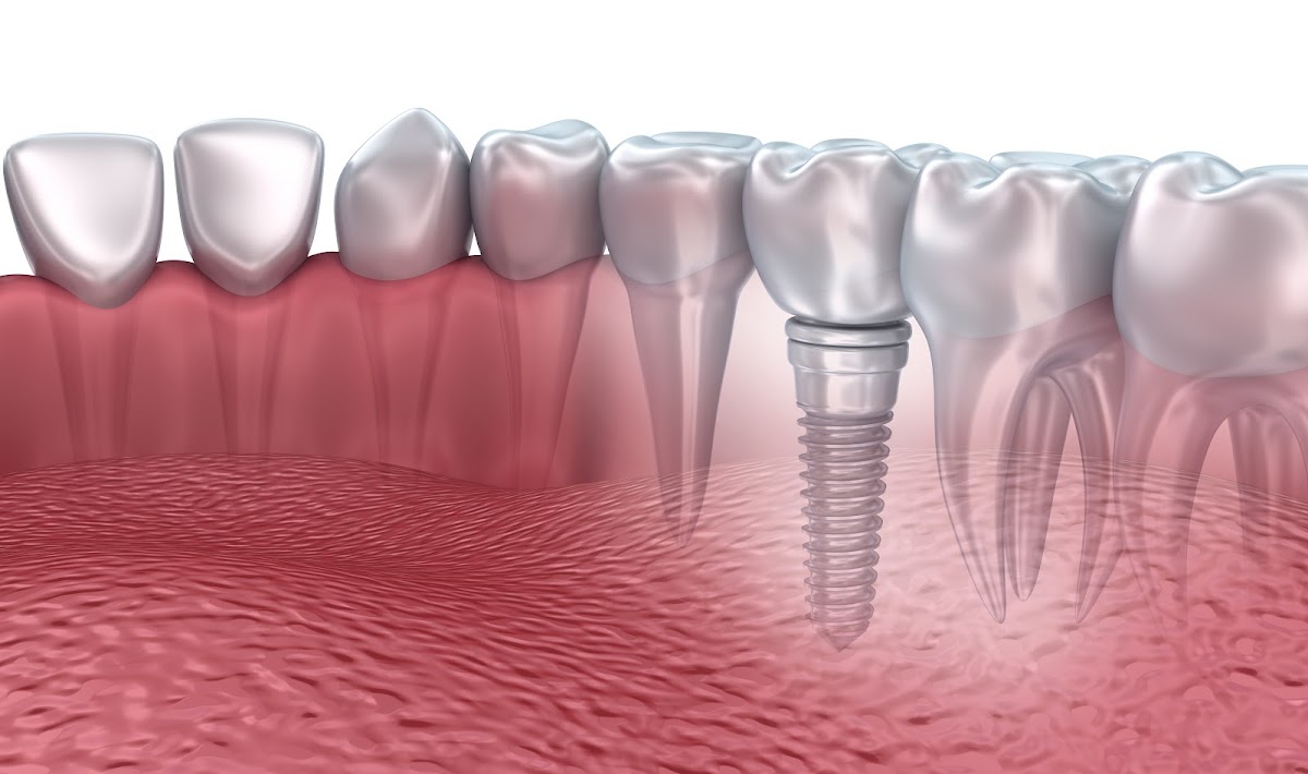 Hudson Valley Periodontics & Implantology photo 6