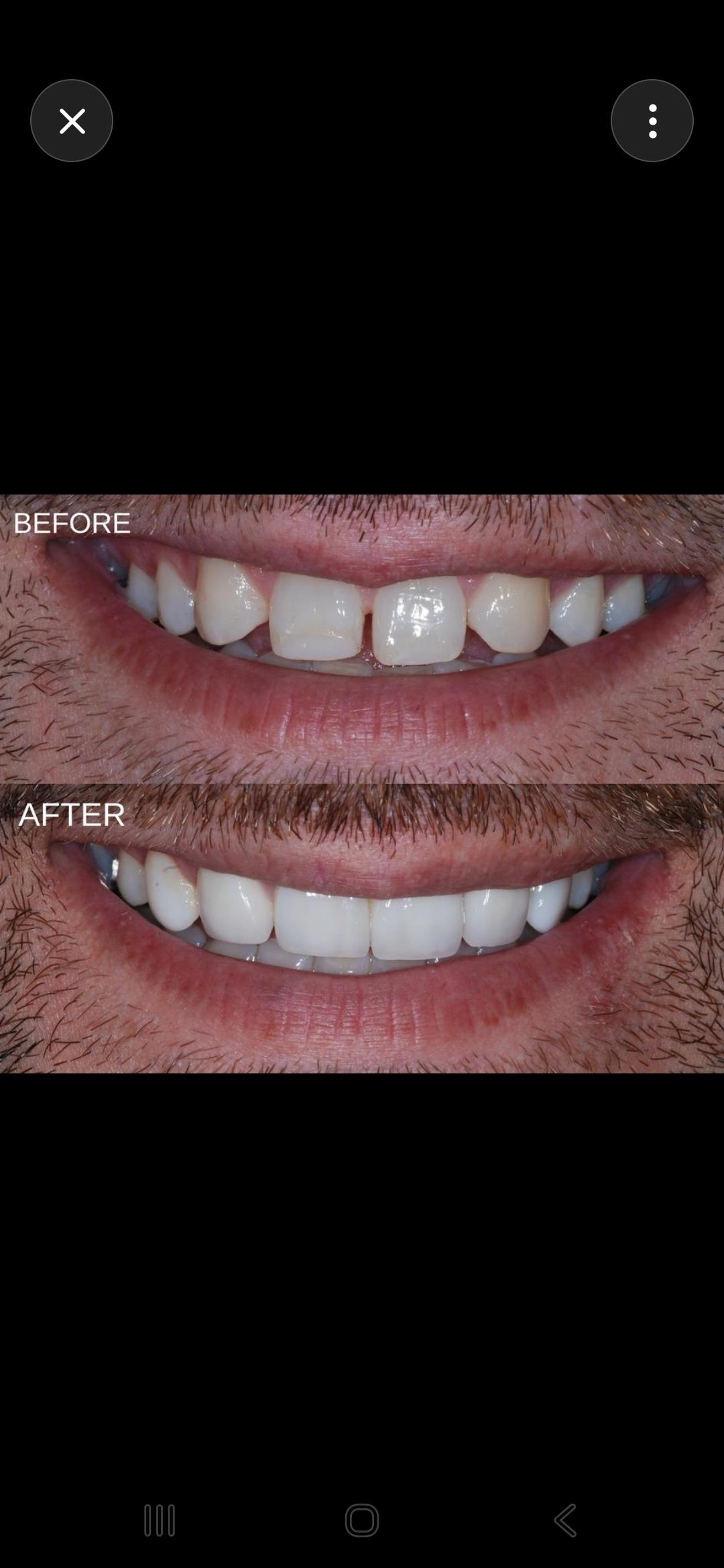 Coral Springs Smiles | Dentist Coral Springs | Emergency & Cosmetic Dentist, Periodontics and Implant Dentistry photo 3