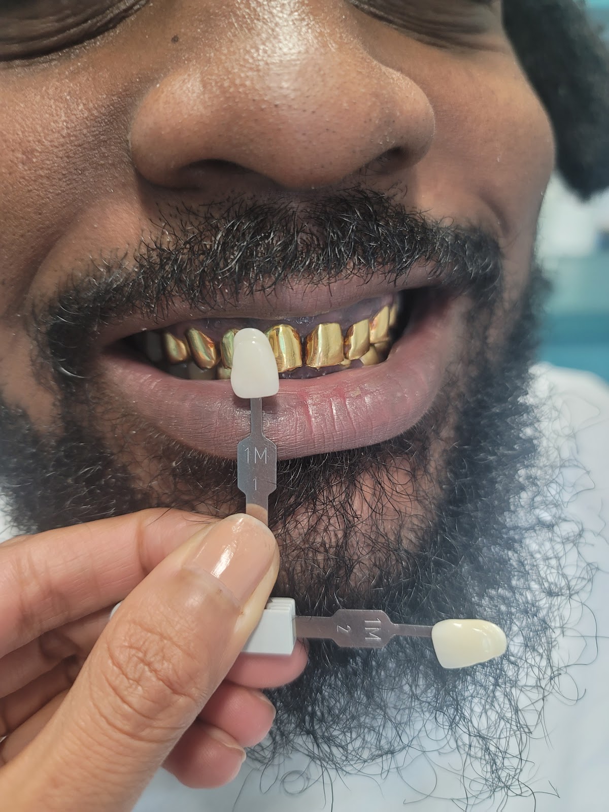 Coral Springs Smiles | Dentist Coral Springs | Emergency & Cosmetic Dentist, Periodontics and Implant Dentistry photo 4