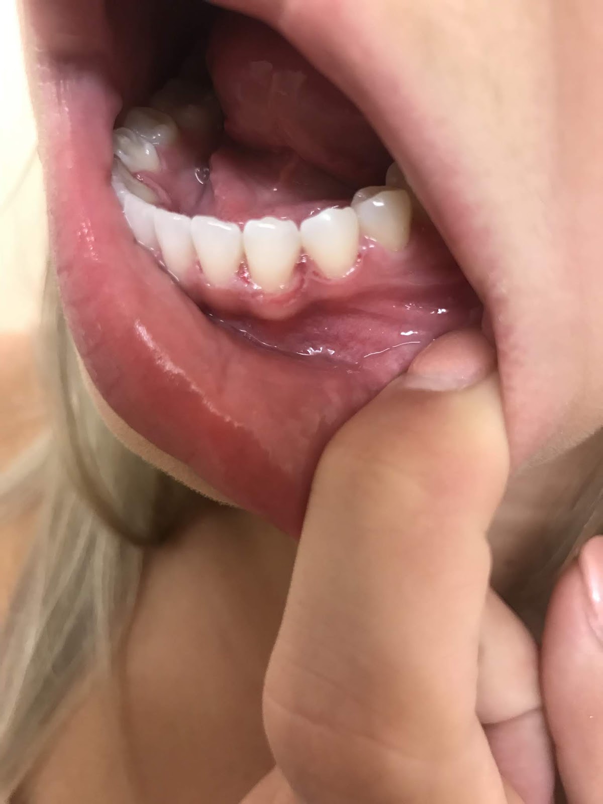 Legacy Dental of Murrieta: Andrew Tibbitts DDS & Associates photo 6