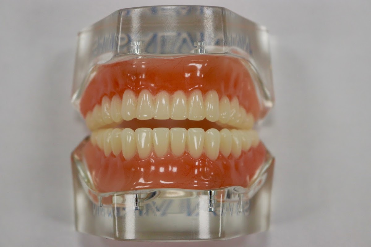 Restore Dentures and Implants photo 3