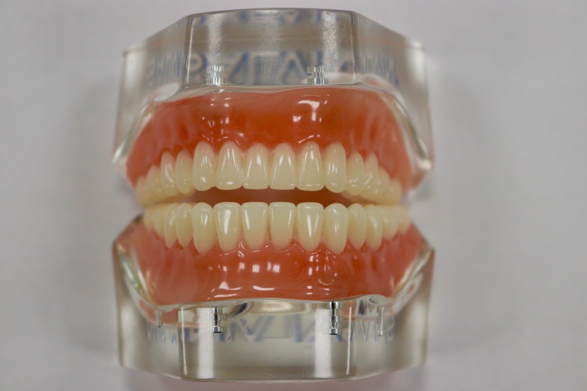 Restore Dentures and Implants photo 3