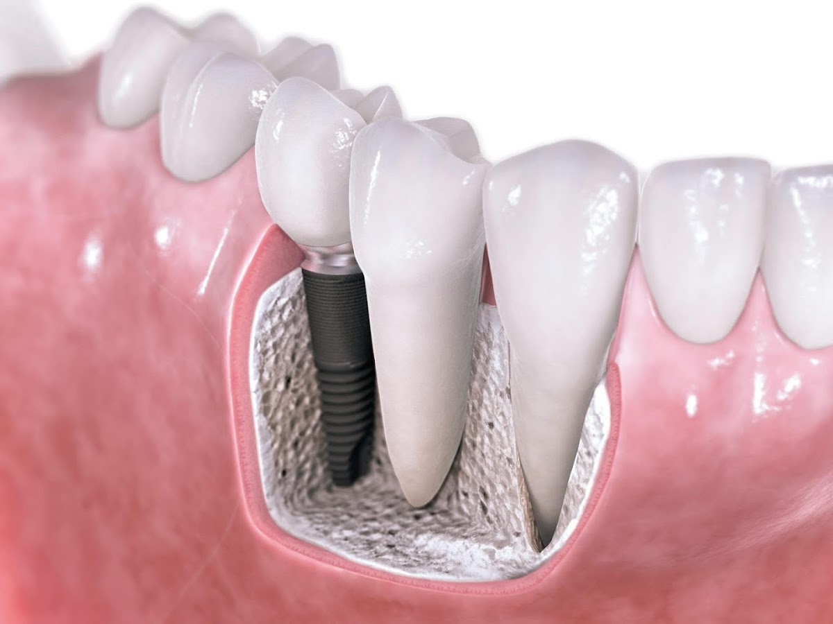Blythe Dental And Implant Center photo 2