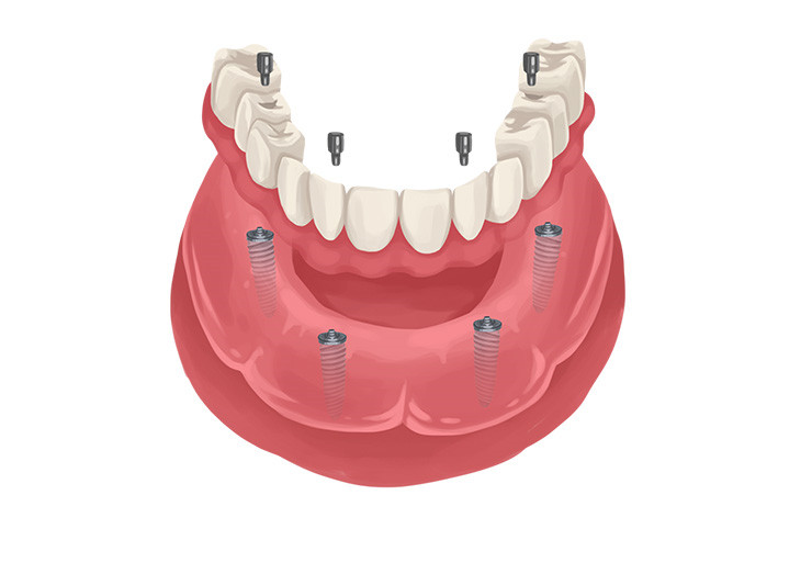 Blythe Dental And Implant Center photo 4