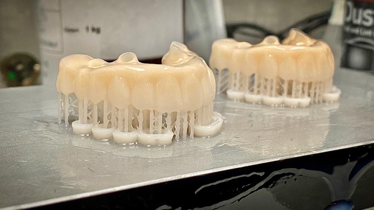 Total Dental Implant Solutions photo 1