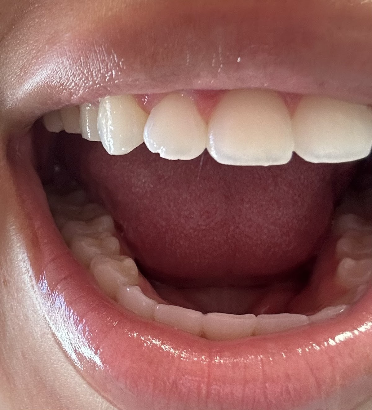 Loma Vista Dental photo 5
