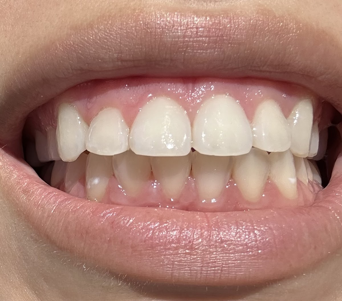 Loma Vista Dental photo 6