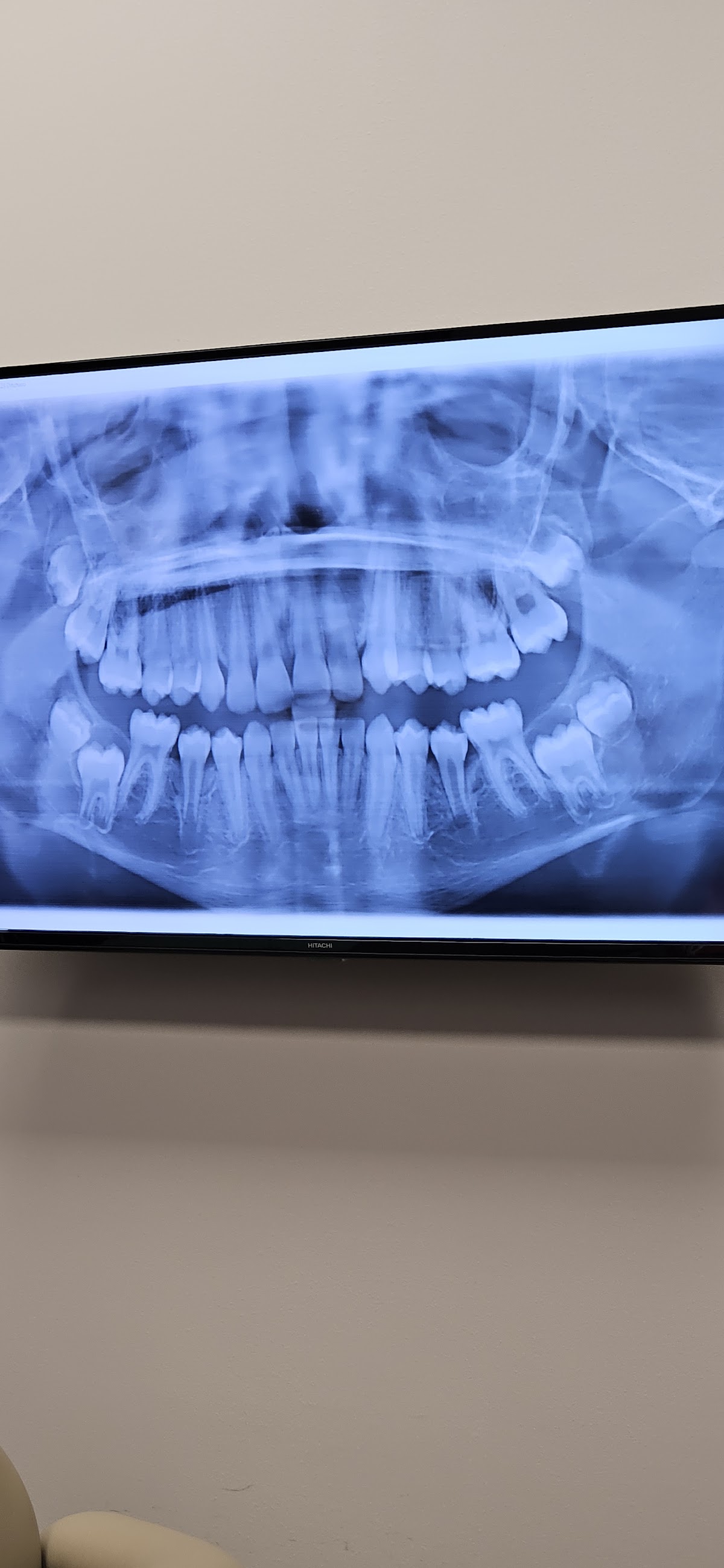 Murfreesboro Oral Surgery and Implant Center photo 3