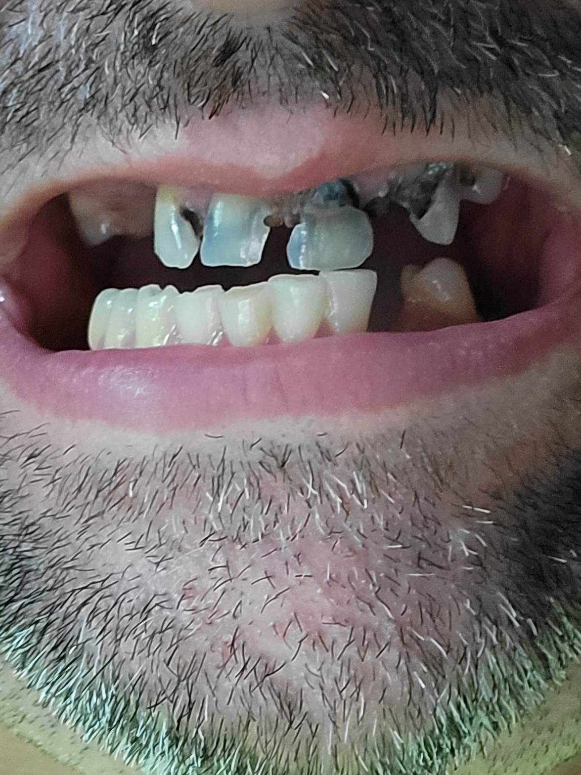 Clearchoice Dental Implant Center - West Chester photo 2