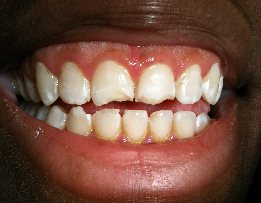 Affordable Dentures Nj photo 2
