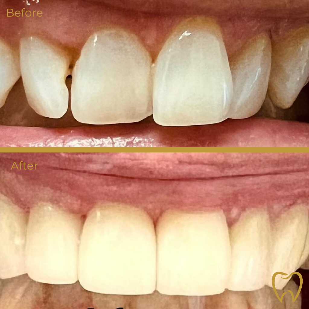Pleasanton Valley Dental Gagandeep Pandher Dds photo 3