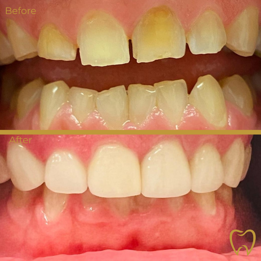 Pleasanton Valley Dental Gagandeep Pandher Dds photo 6