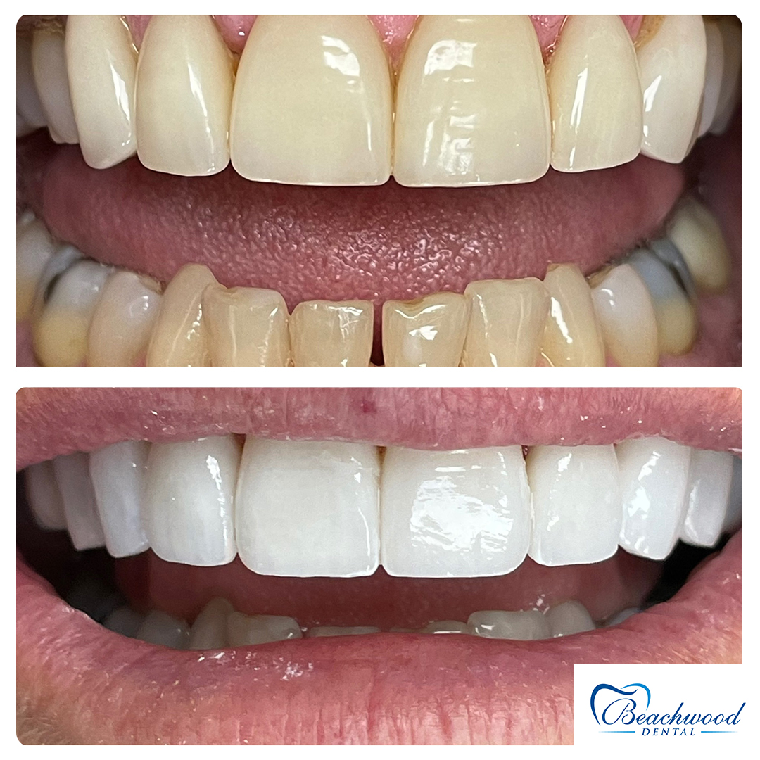 Beachwood Dental photo 3