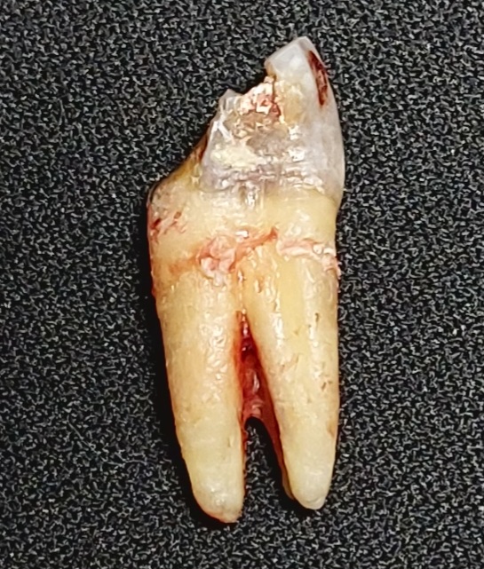 Dream Dental Implant Center photo 6